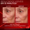 Creme de Olhos Corretor Revitalift Laser