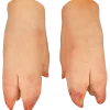 Unha de Porco